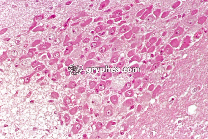 Hypothalamus x100 - gryphea.com